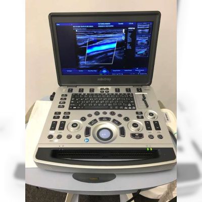 Mindray M8 Elite Ultrasound Machine